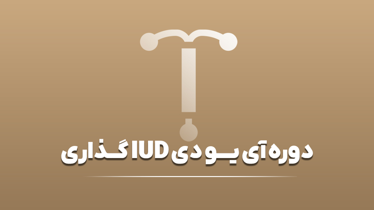 دوره آی یو دی گذاری