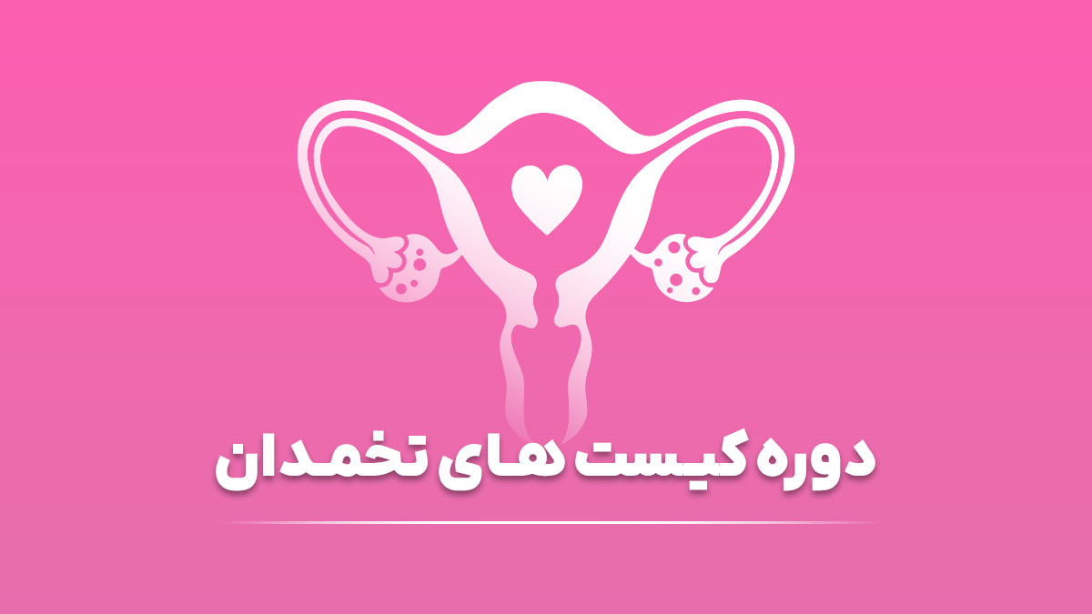 دوره کیست تخمدان