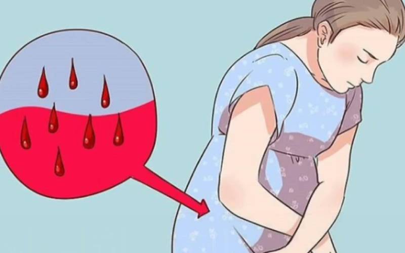 انواع خونریزی در بارداری و دلایل آن 2 انواع دلایل ثانویه خونریزی بارداری