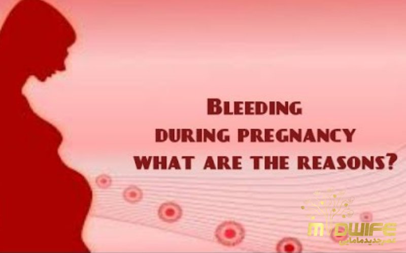 انواع خونریزی در بارداری و دلایل آن 3 دلیل انواع خونریزی بارداری