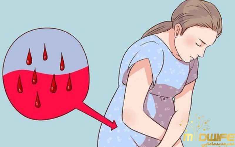 خونریزی در بارداری