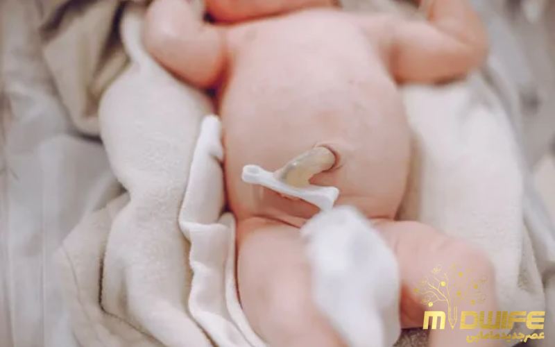 مراقبت از ناف نوزاد بعد از افتادن 4 سوالات افتادن بند ناف
