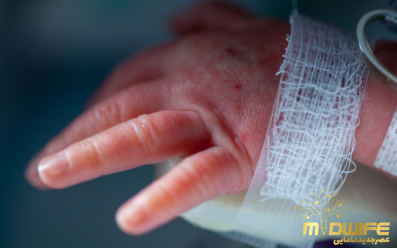 مراقبت از نوزاد نارس در منزل 4 مراقبت پوست نوزاد نارس