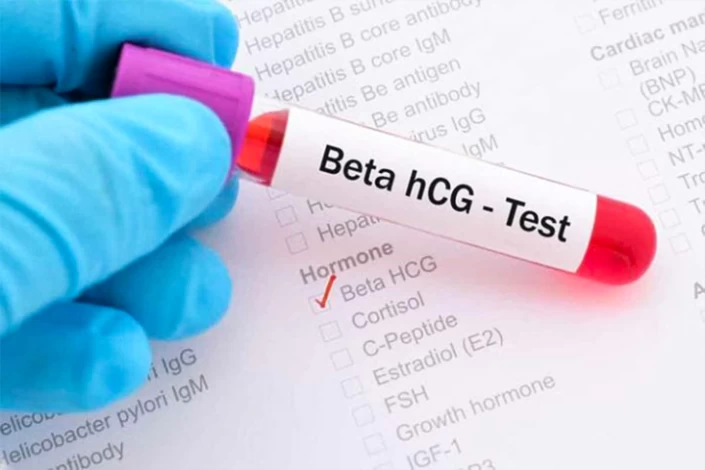 تست خون بارداری