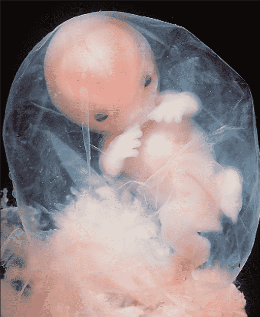 تصویر جنین در 10 هفتگی