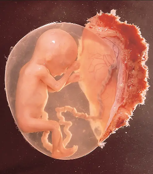 جنین در 18 هفتگی