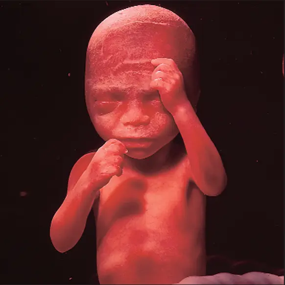 جنین در 24هفتگی