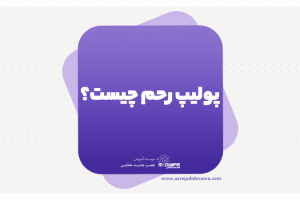 what-is-a-uterine-polyp-4